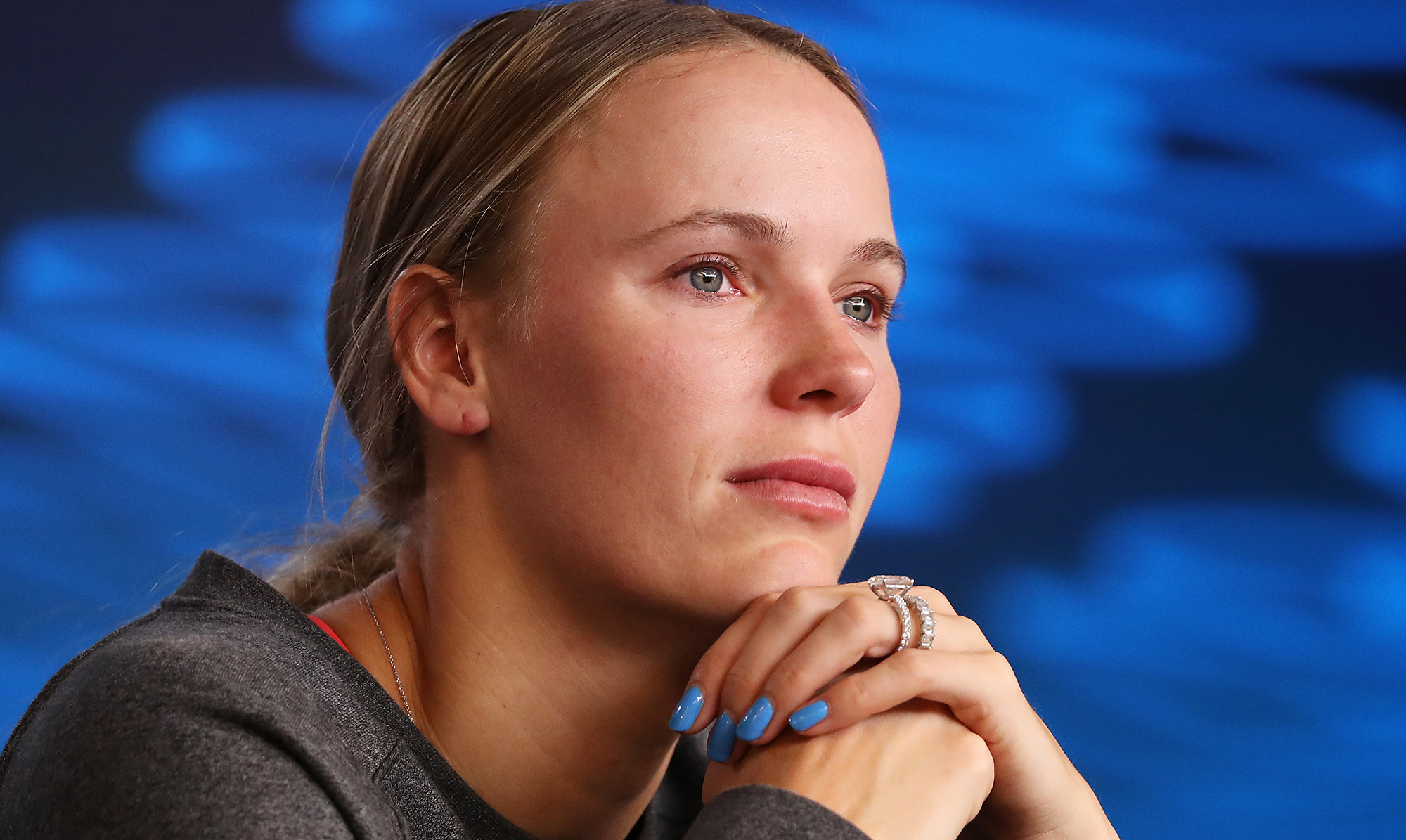 Caroline Wozniacki åbner op om at leve med kronisk leddegigt. Caroline Wozniacki