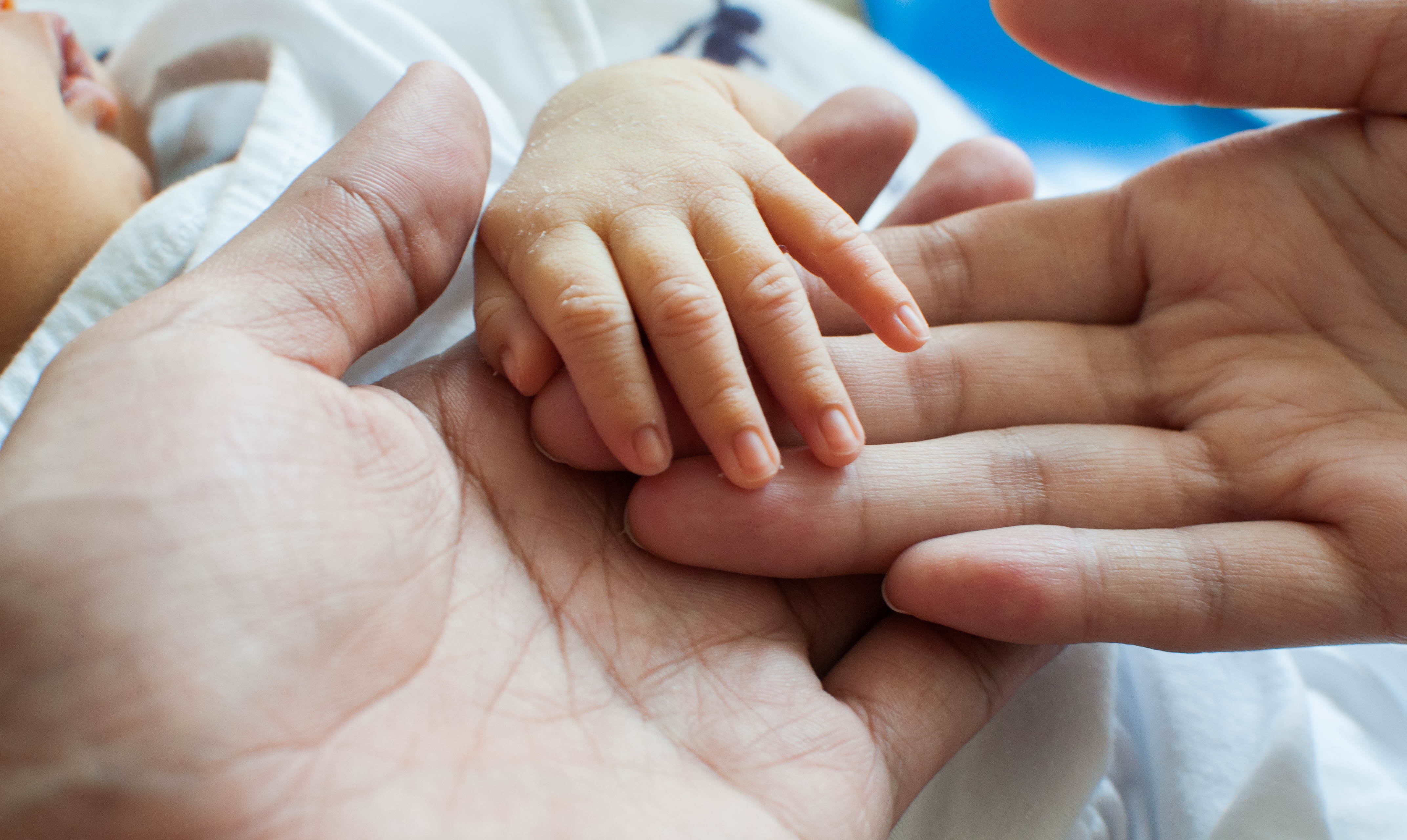 Har din lille nyfødte baby en gul kulør? Det er faktisk helt normalt. Vi har samlet alt, du skal vide om gulsot her. Baby med gulsot