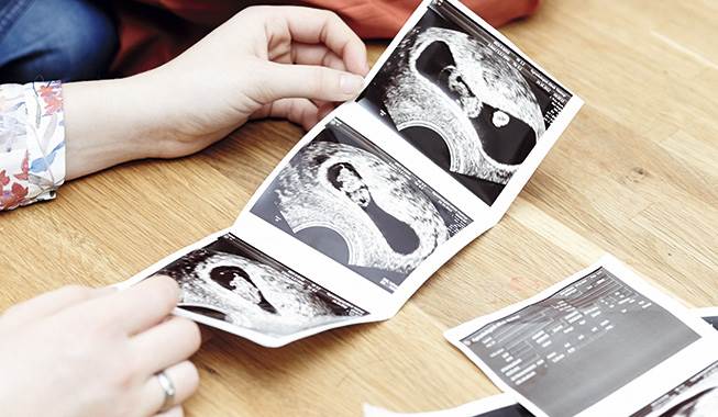 “Det kan overraske, at længslen efter et bestemt køn til din baby er så stærk”. Babys køn: Blev du (også) skuffet?