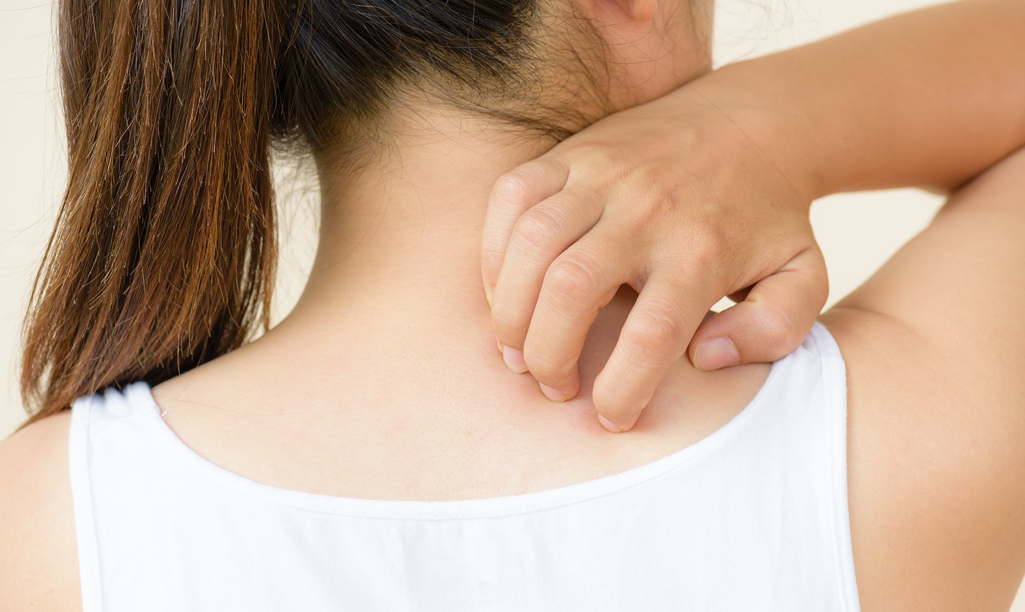 Fnat: Symptomer og behandling - ALT.dk Fnat: Symptomer og behandling - ALT.dk