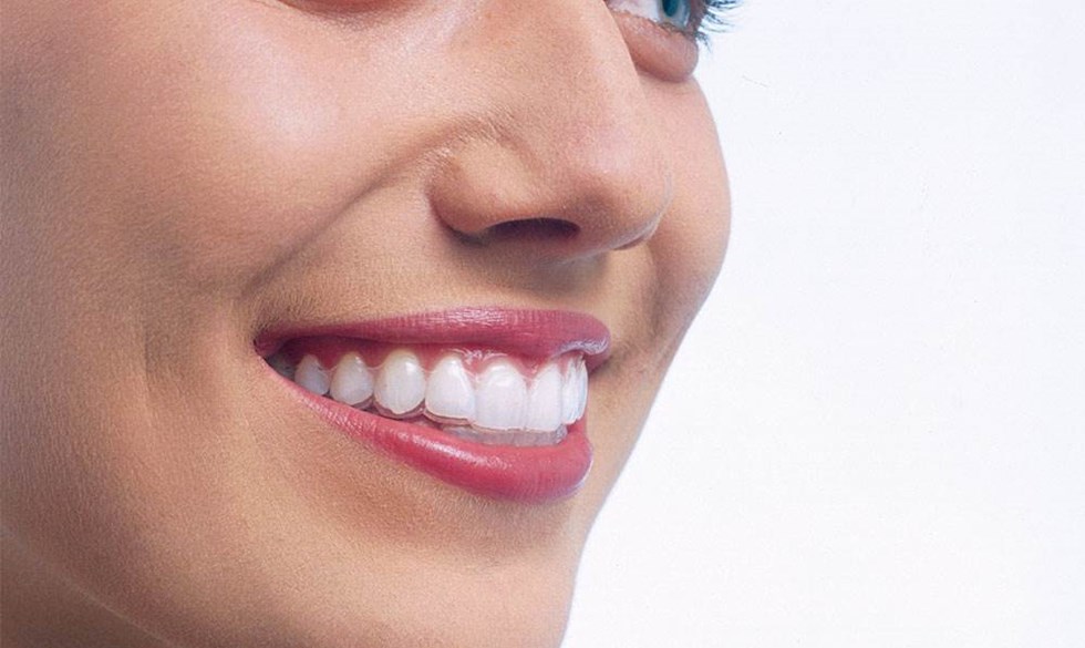 Præsenteret af Invisalign